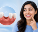 Single Missing Tooth