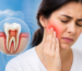 Tooth Pain